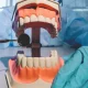 Dental Implants in Frisco TX