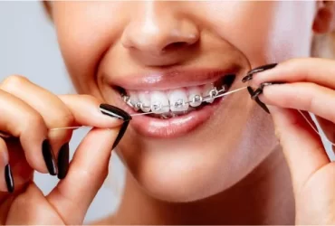 dental braces frisco