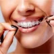 dental braces frisco