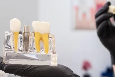 Relieve Pain From a Dental Implant