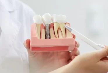 heal faster after dental implants
