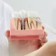 heal faster after dental implants