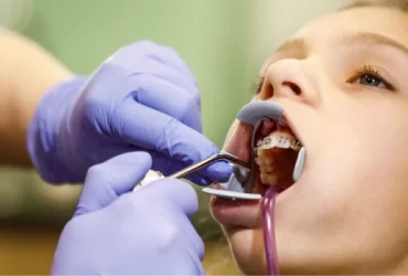 How Long Do Denture Teeth Last?