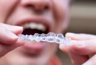 How Long Does Invisalign Take?