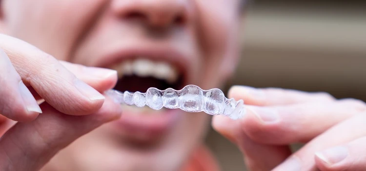 How Long Does Invisalign Take?