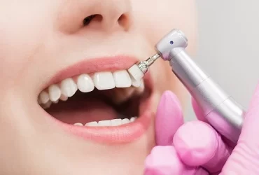 How Long Does Teeth Whitening Last?