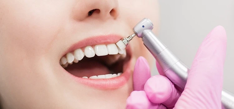 How Long Does Teeth Whitening Last?