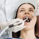 Dental Cleaning Types