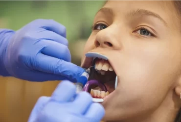 Dental Bonding: How Long Does It Last?
