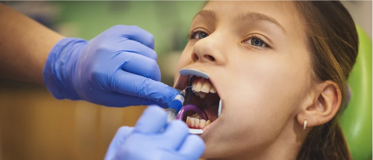 Dental Bonding: How Long Does It Last?