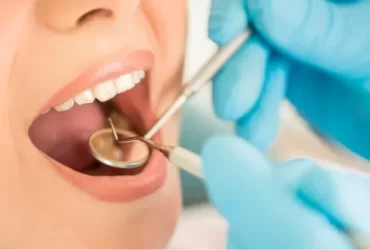 Benefits Of Regular Dental Check-Ups