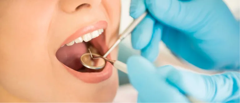 Benefits Of Regular Dental Check-Ups